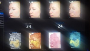 Facial Before and After Pictures - Client Scores 10 Years Younger than Her Actual Age!