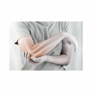 Amazing link between osteoporosis and wrinkles